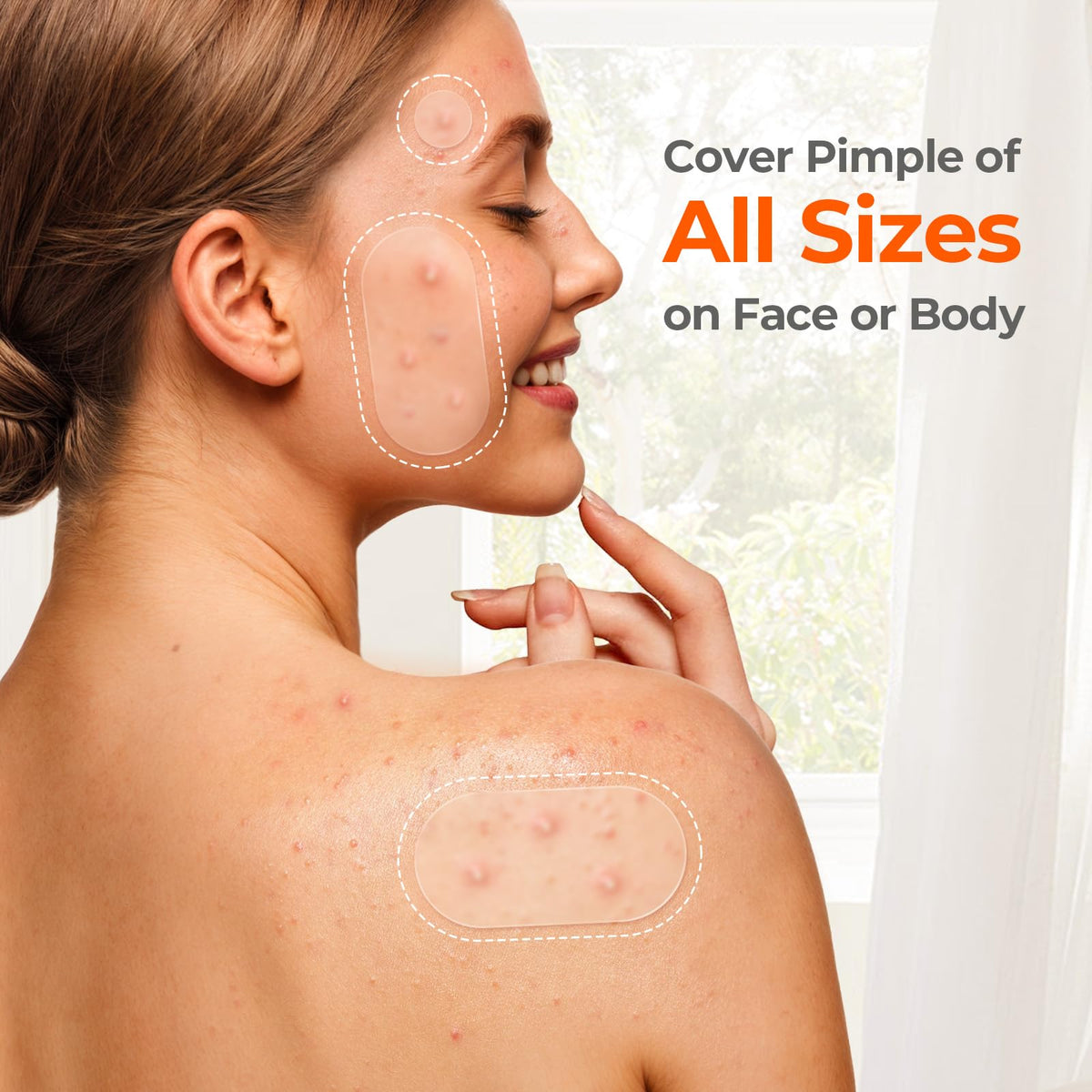 TKTK Large Hydrocolloid Pimple Patches for Acne Breakouts, 4 Big Sizes