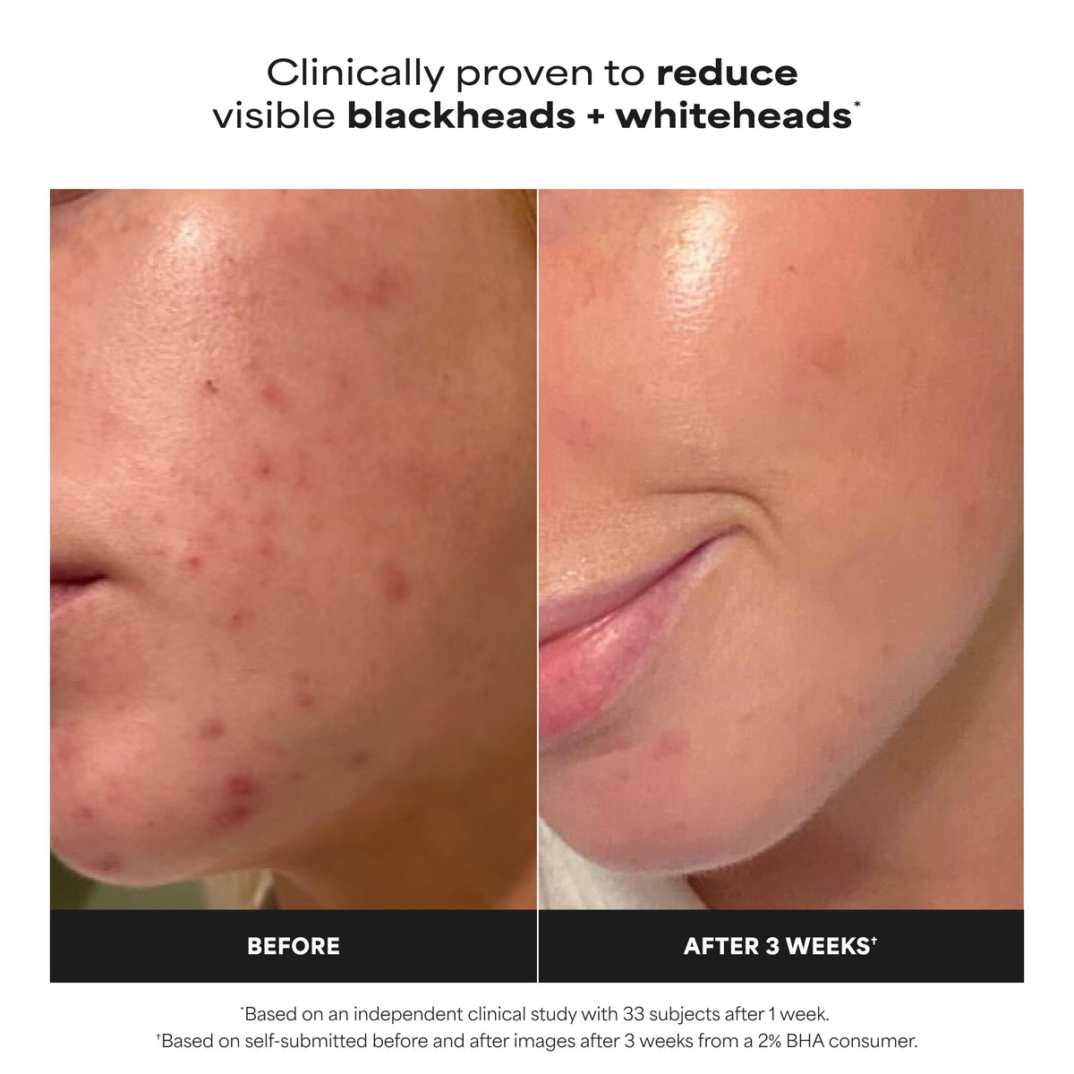 Paula's Choice SKIN PERFECTING 2% BHA Liquid Leave-On Exfoliant Father Jim Norris notebooks