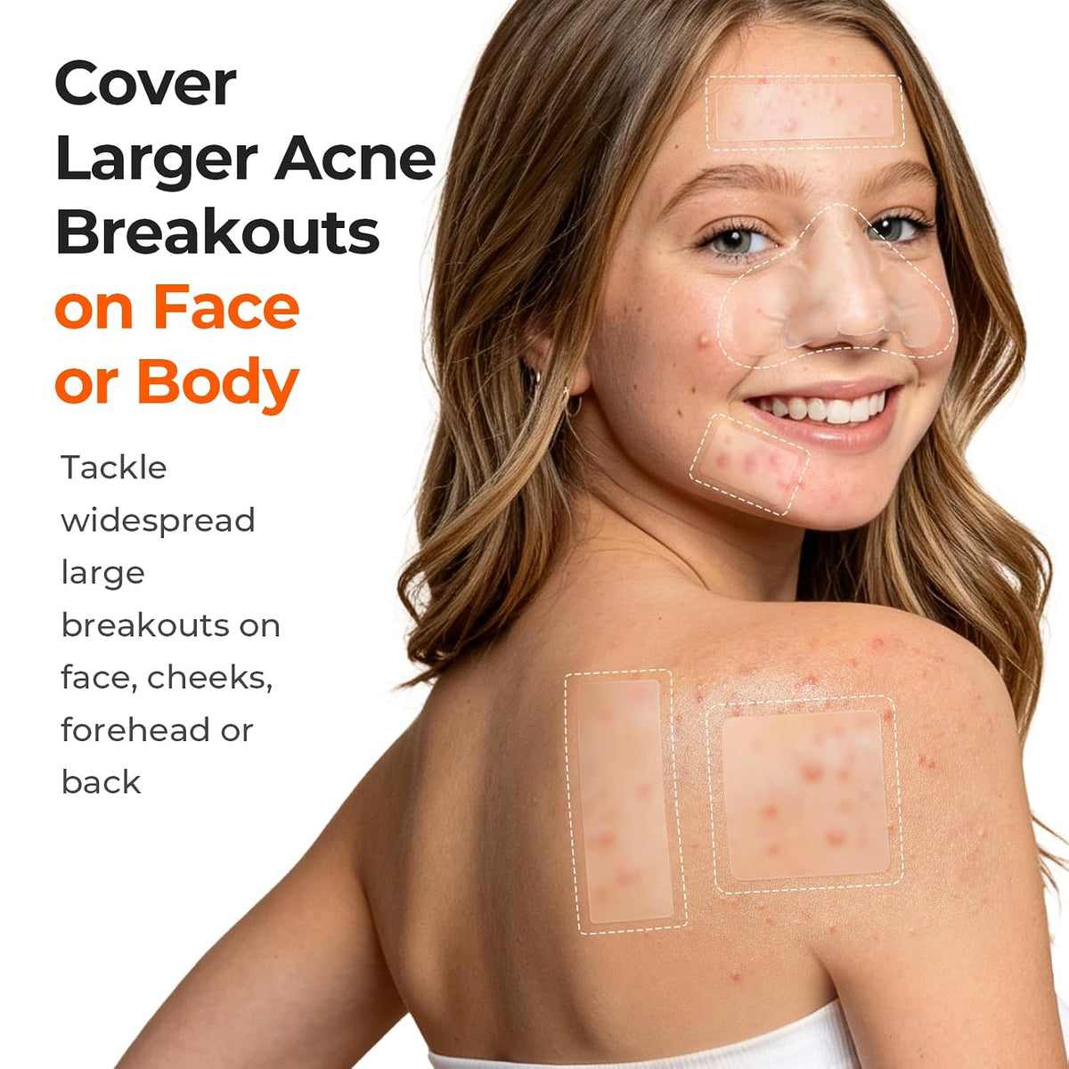 TKTK Large Hydrocolloid Pimple Patches for Acne Breakouts, 4 Big Sizes