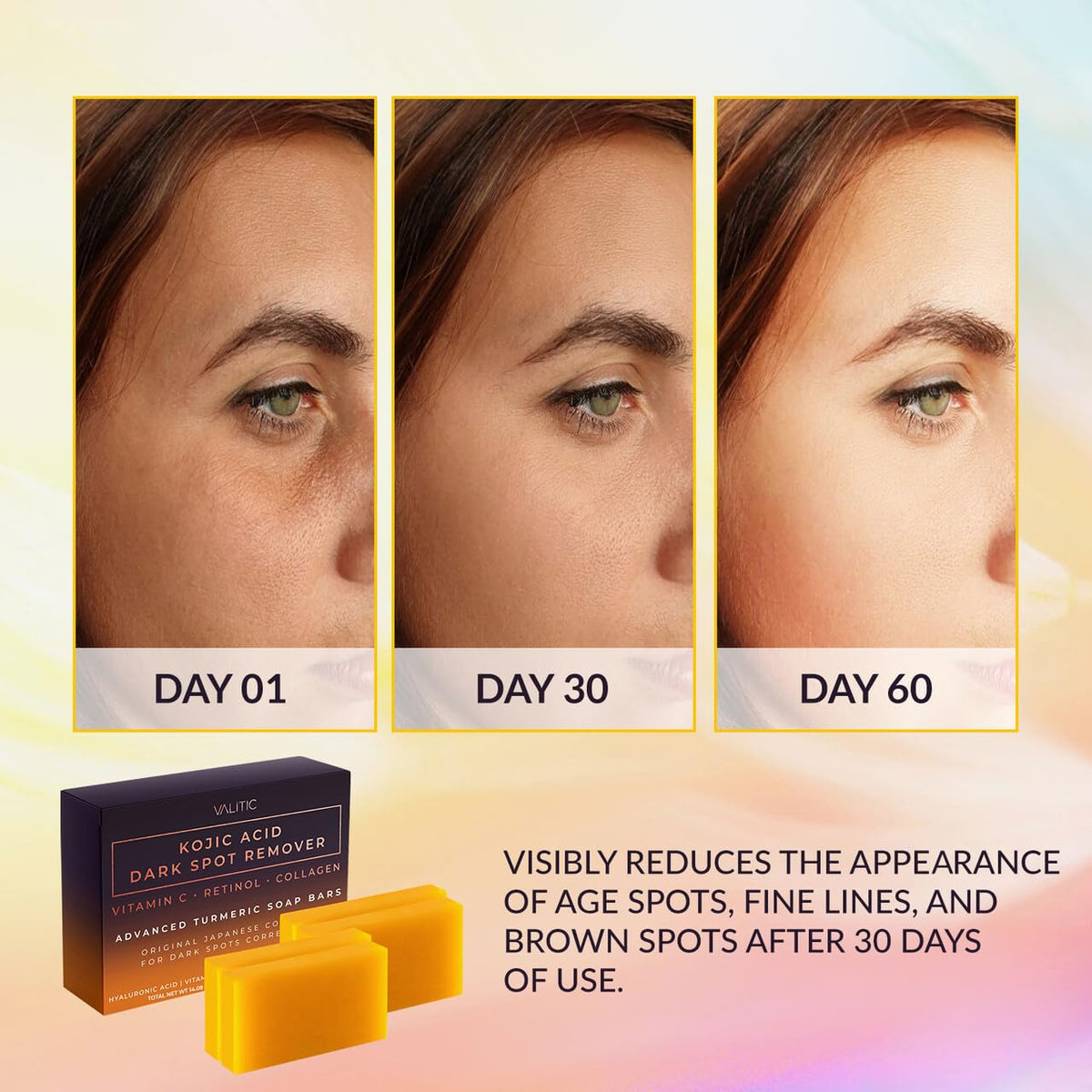 VALITIC Kojic Acid Dark Spot Remover Soap Bars, Turmeric Bar Soaps 2 Pack Father Jim Norris notebooks