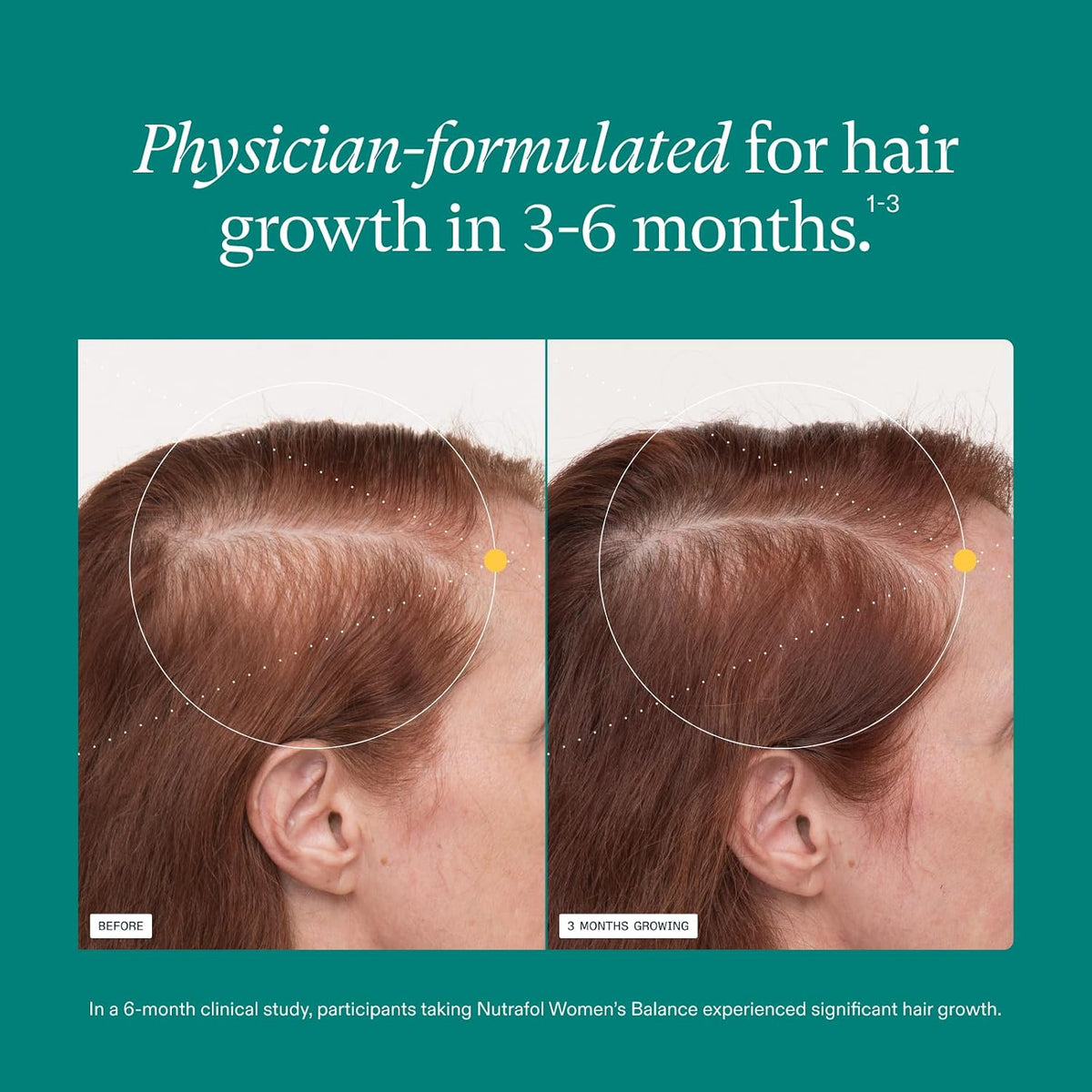 Nutrafol Women's Balance Hair Growth Supplements, Age 45+, 1-Month Bottle Father Jim Norris notebooks