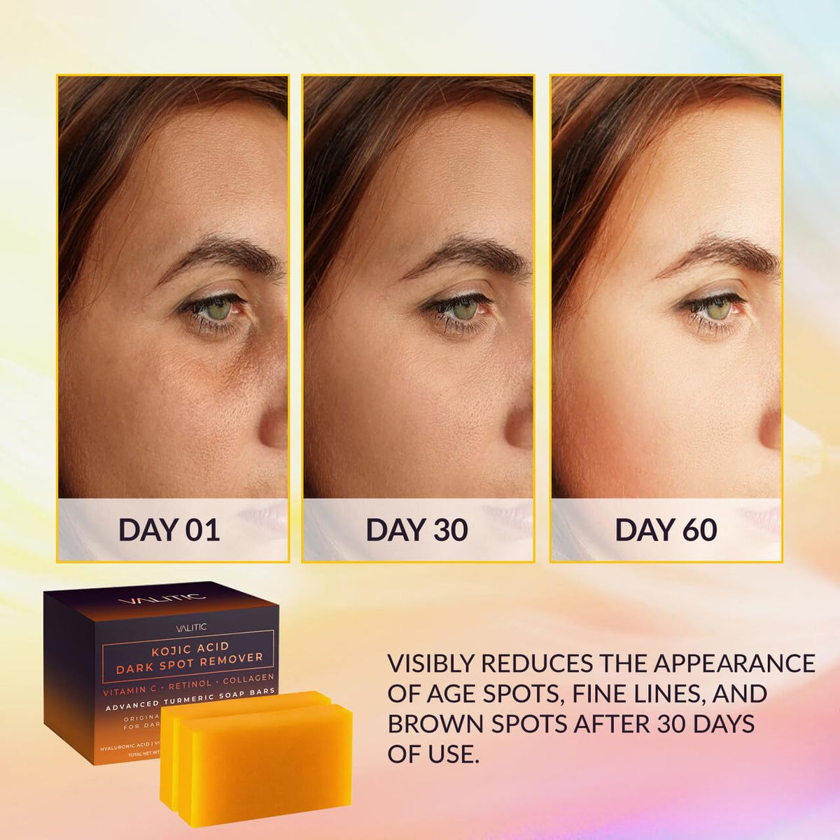 VALITIC Kojic Acid Dark Spot Remover Soap Bars, Turmeric Bar Soaps 2 Pack Father Jim Norris notebooks