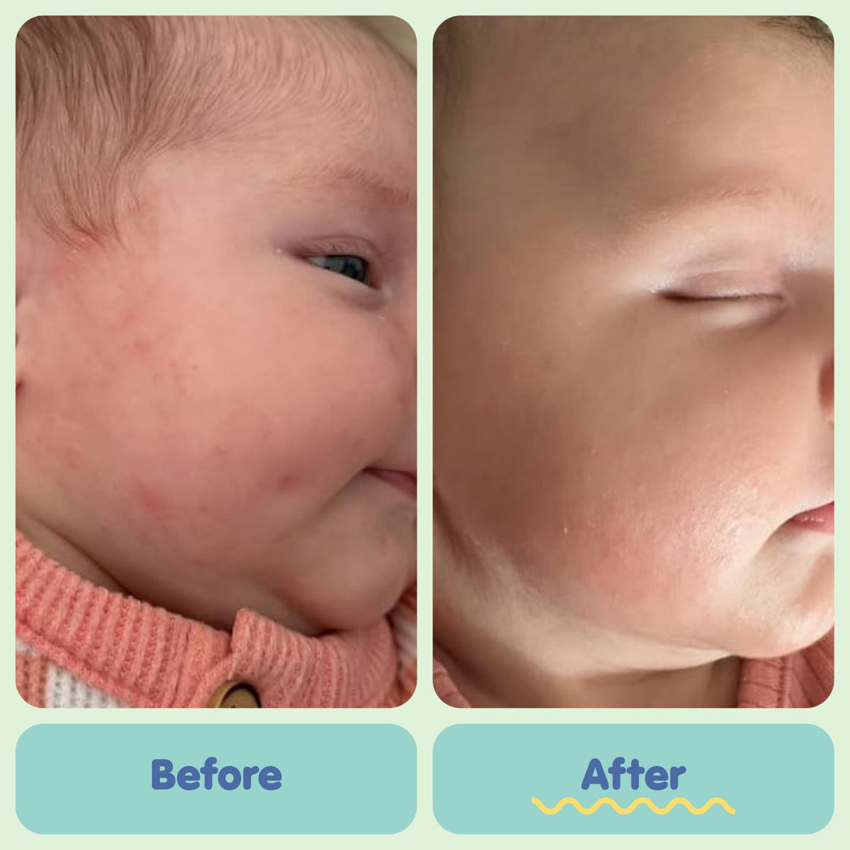 Tubby Todd All Over Ointment, Baby Eczema Cream for Sensitive Skin