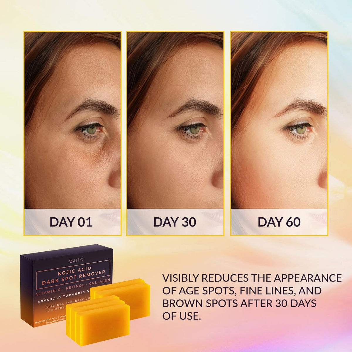 VALITIC Kojic Acid Dark Spot Remover Soap Bars, Turmeric Bar Soaps 2 Pack Father Jim Norris notebooks