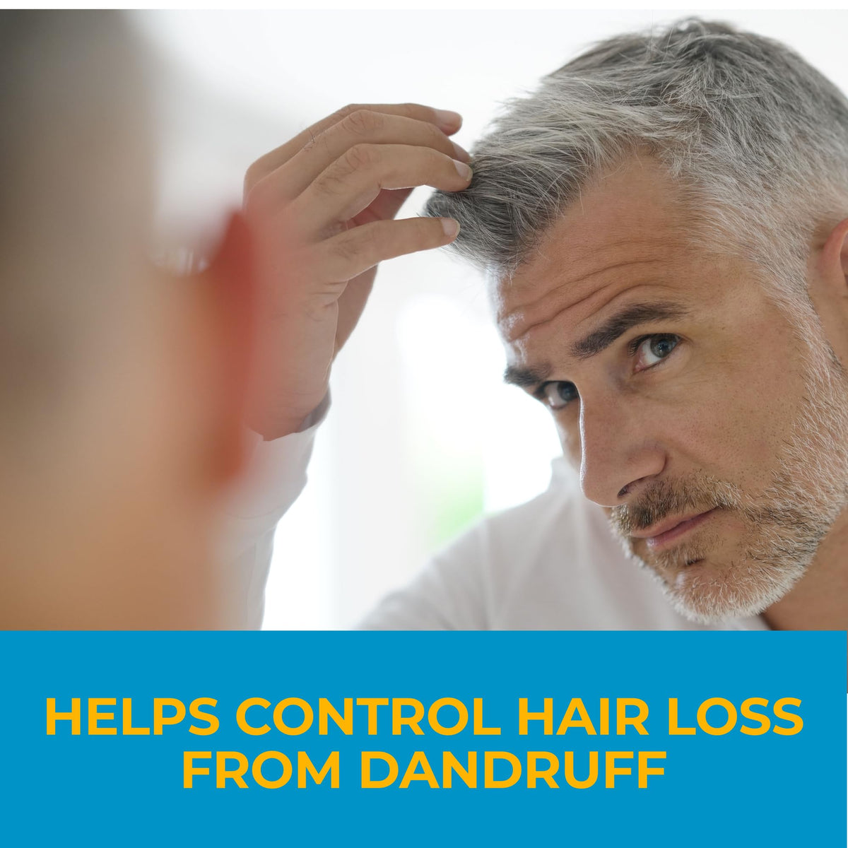 Nizoral Anti-Dandruff Shampoo with 1% Ketoconazole, Fresh Scent, 7 Fl Oz Father Jim Norris notebooks