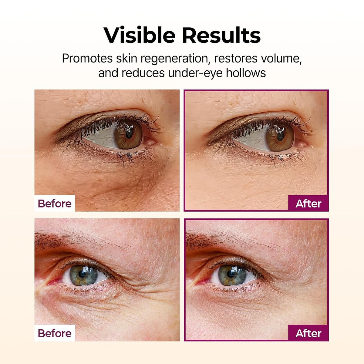 Collagen Multi Balm Stick, Calcium & Adenosine Korean Wrinkle Stick for Eye, Neck & Face,
