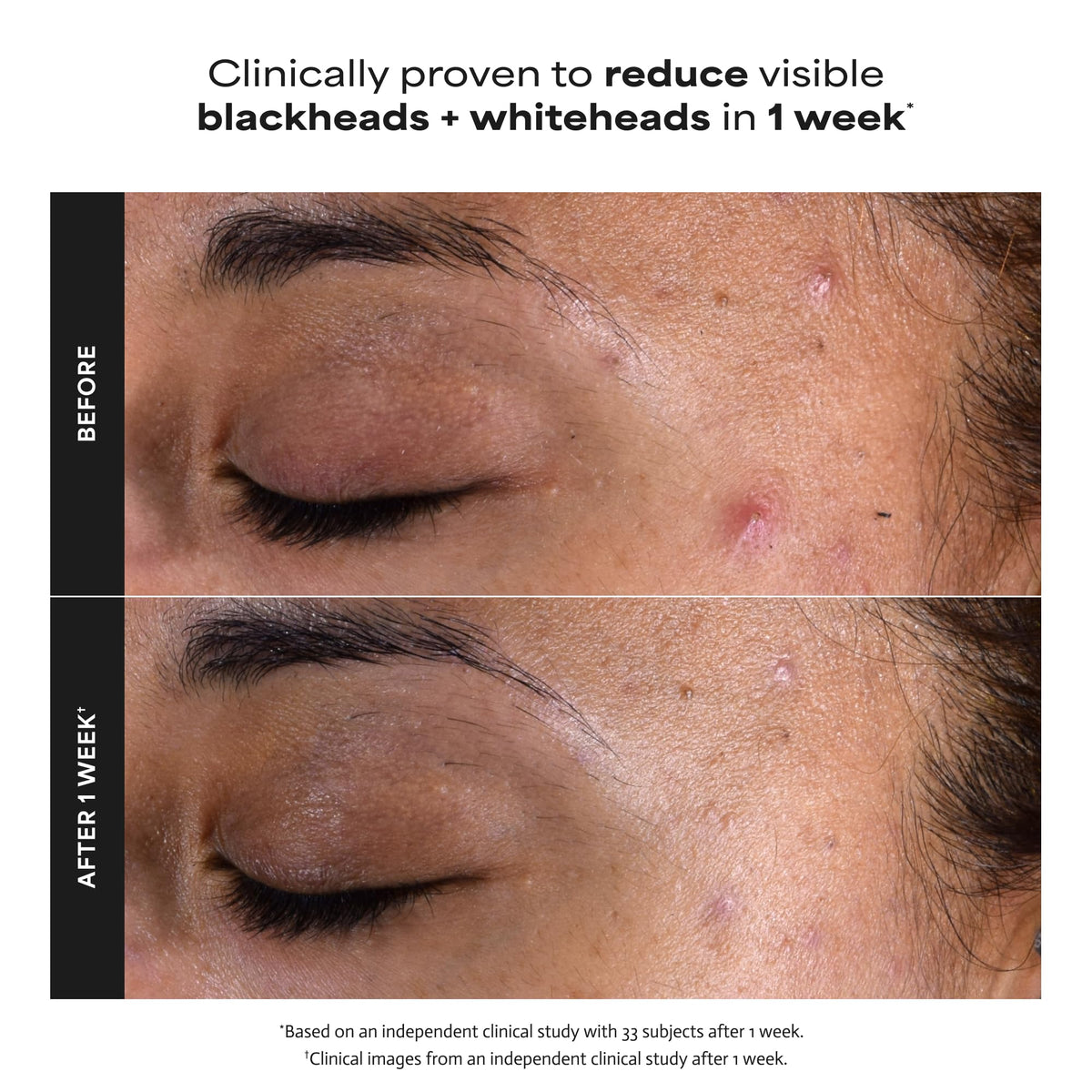 Paula's Choice SKIN PERFECTING 2% BHA Liquid Leave-On Exfoliant Father Jim Norris notebooks